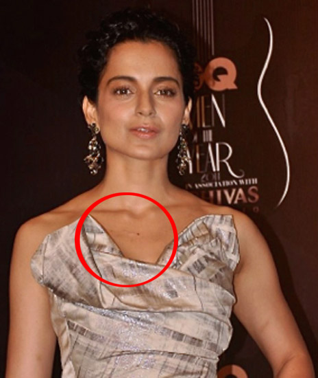 kangna ranaut with a hickey