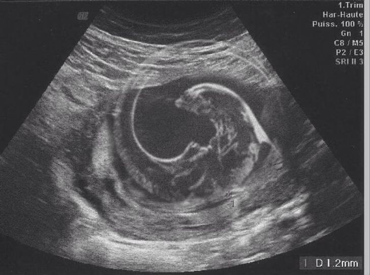 ultrasound report of a couple who made it funny